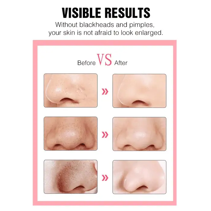 دستگاه پاکسازی صورت هیوندای کره HYUNDAI FC-038